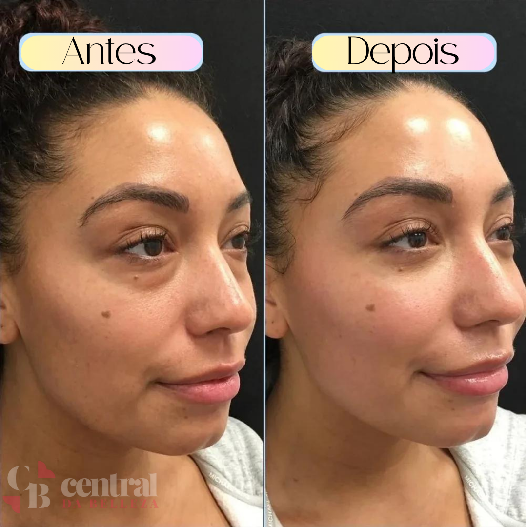 DermaGlow - Dark Circle Eliminator