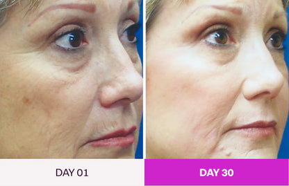 SkinLift - Facial Renewal