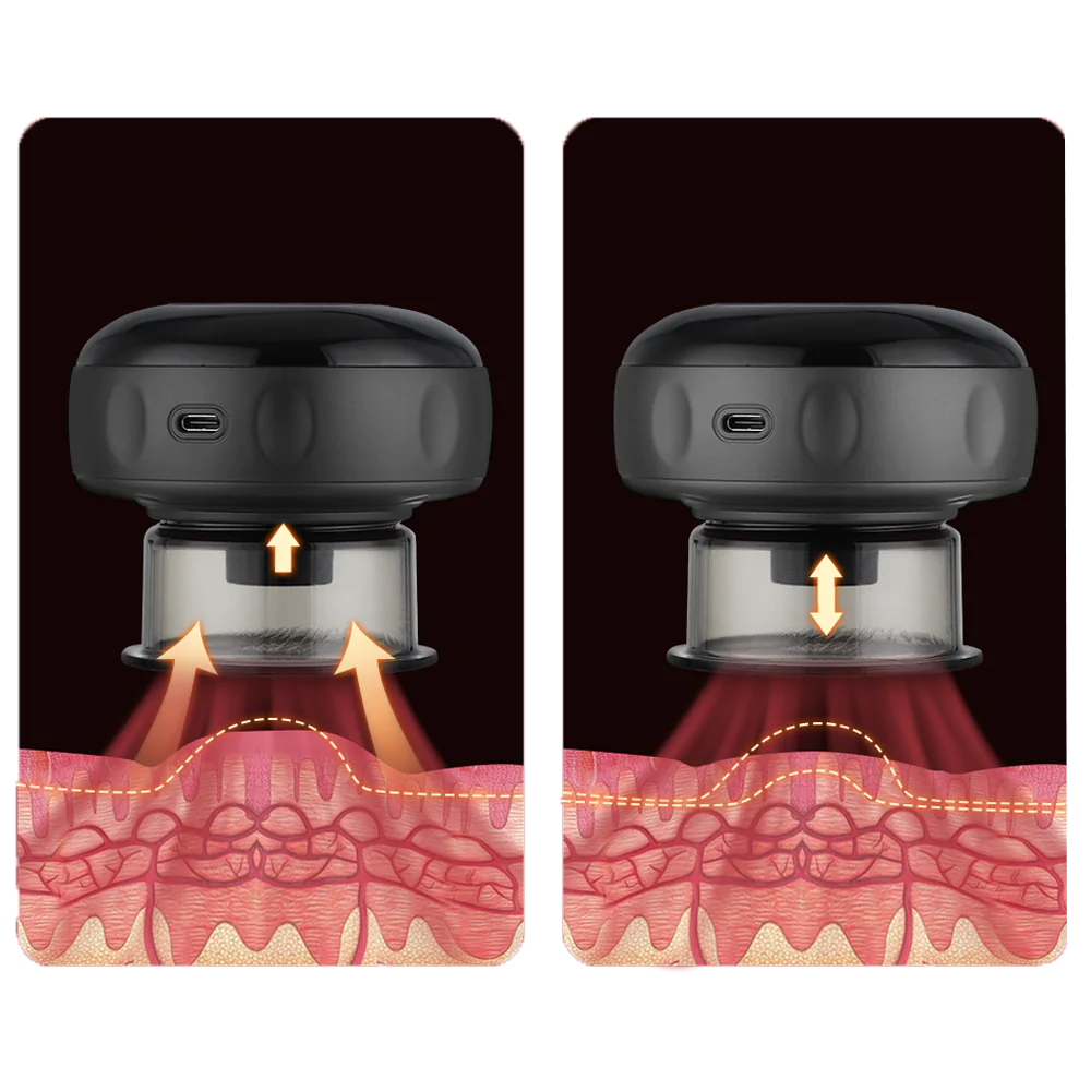 Smart Cupper Detox™" can be rewritten as "Intelligent Detox Cup™.